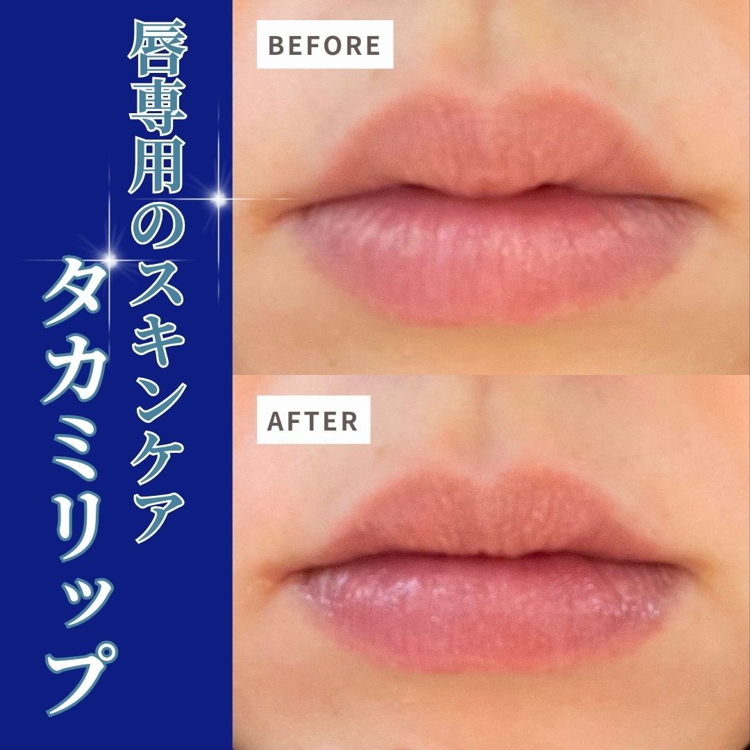 タカミリップ 4本セット TAKAMI タカミリップ 4本セット TAKAMI タカミ / タカミリップの公式