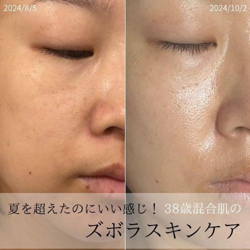 夏の紫外線で疲れ切った肌なのに毛穴が目立たなくなったと言われた38歳