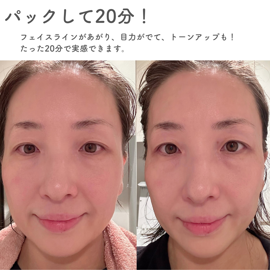 たった20分でフェイスラインも目力も明らかに変わった