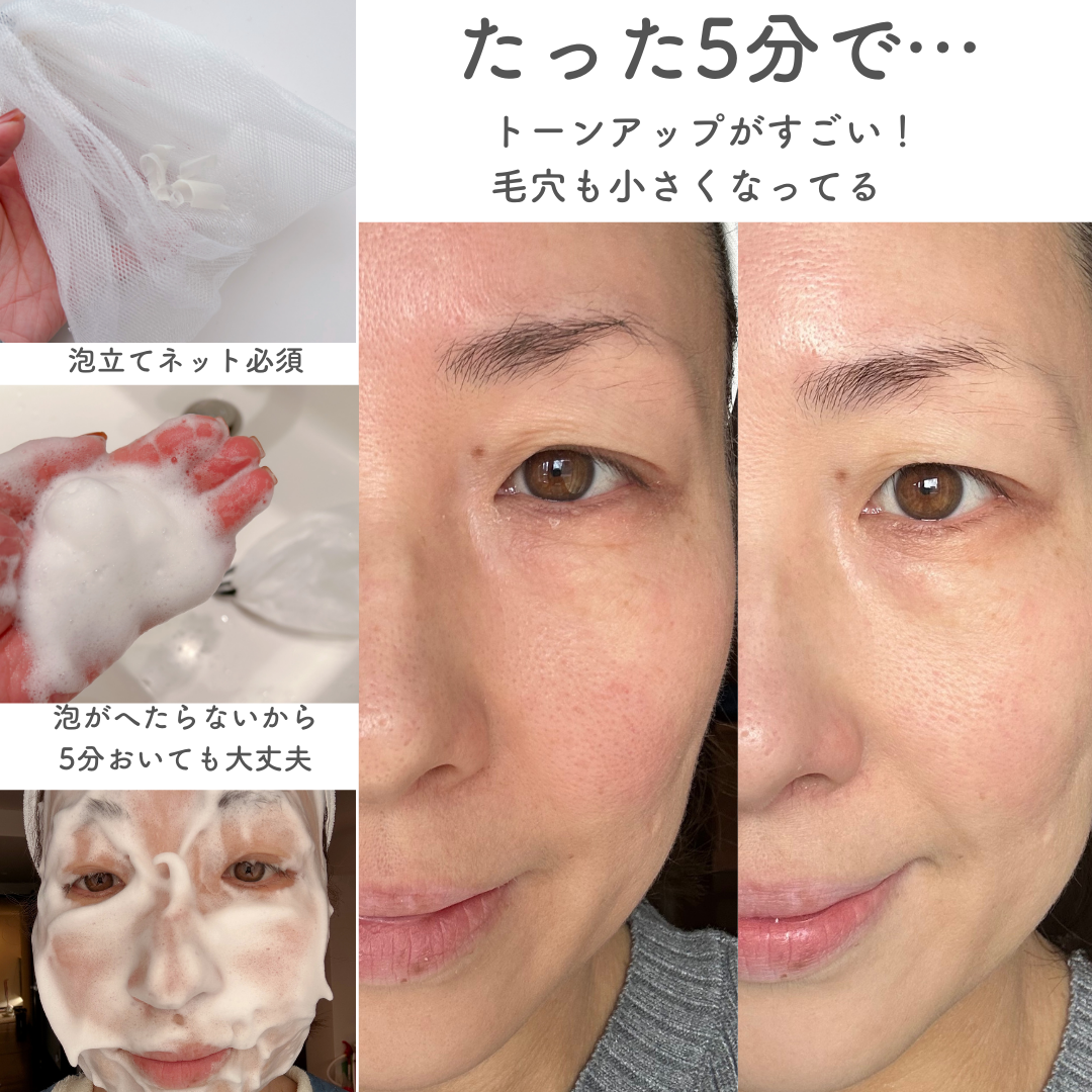 石鹸なのにパックもできちゃう！】泡で5分パックしたら小鼻の黒ずみも