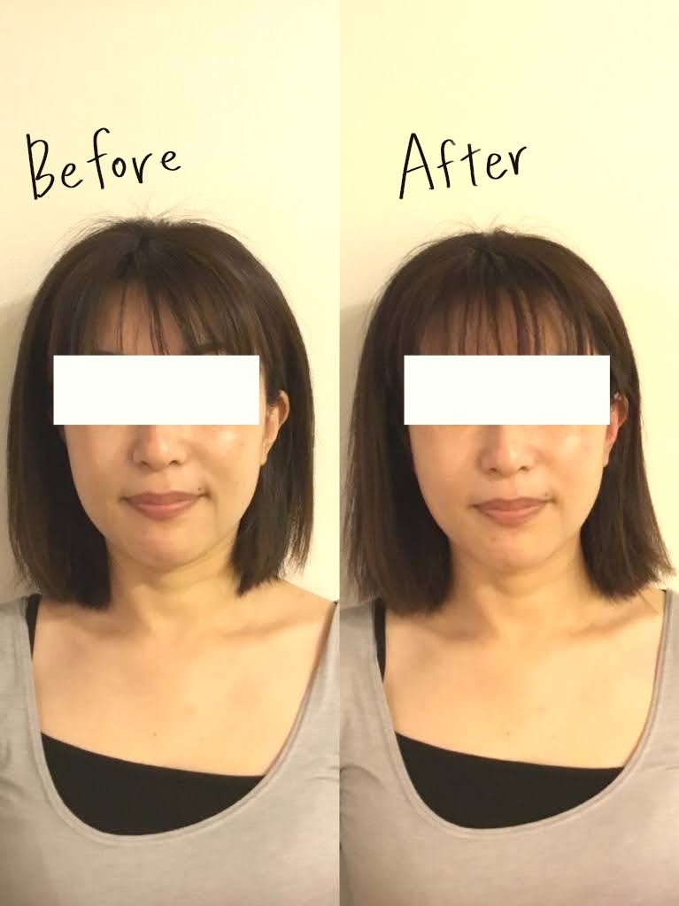 初期モデル 電気バリブラシ スキンローション付き 初期モデル電気