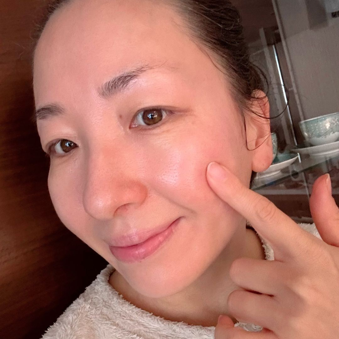 美肌のピークを取り戻したい方必見！高額だけど肌のハリを手に入れられ