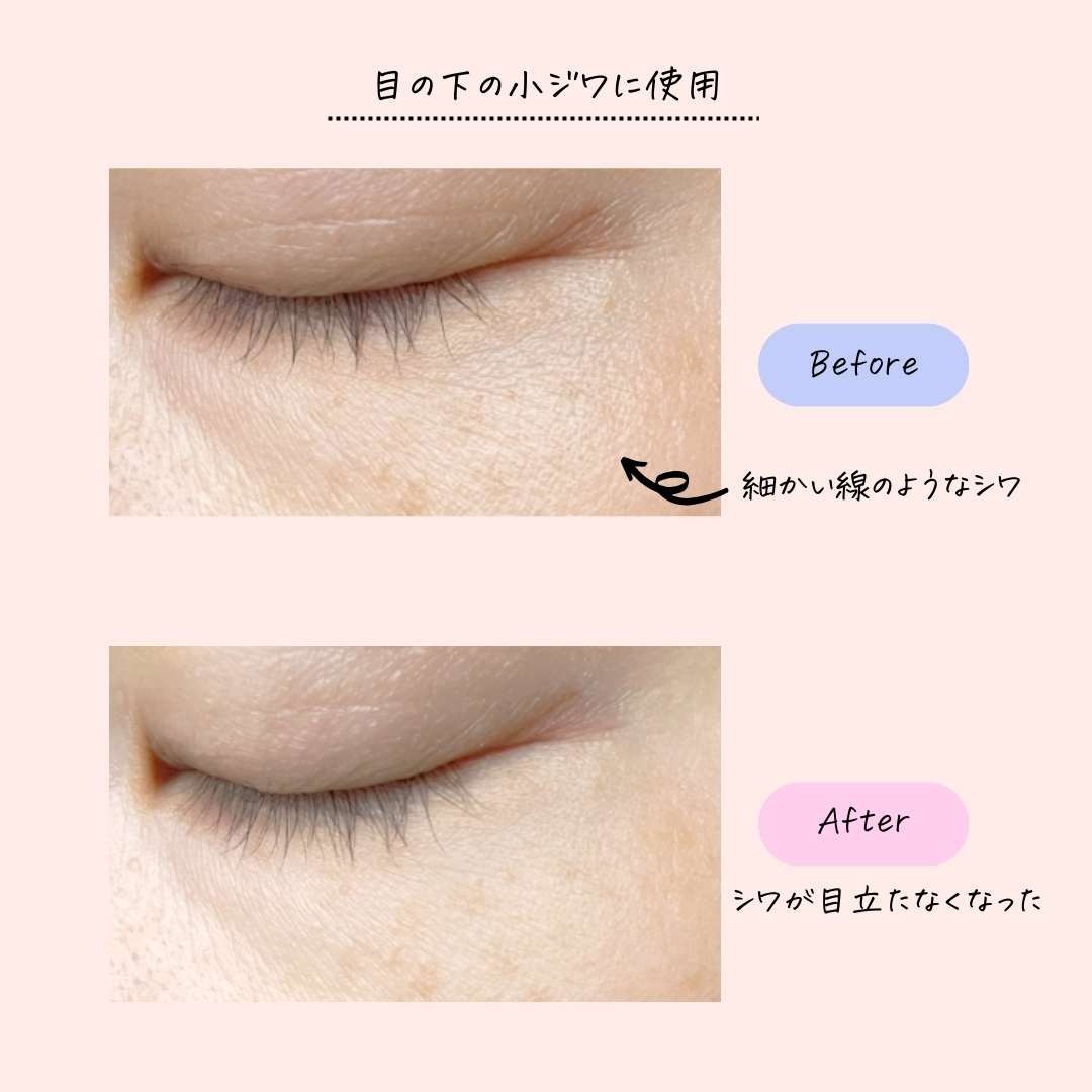 期待以上！シワへ塗って目立ちにくく！しわ改善と美白対策に