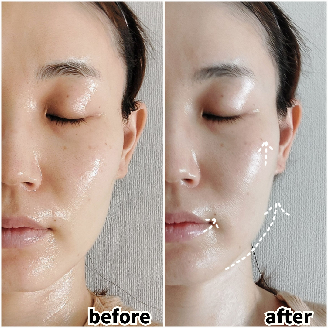 PLUS フェイスケア GEL PGN-204 フェイシャルエステ プレミアム 