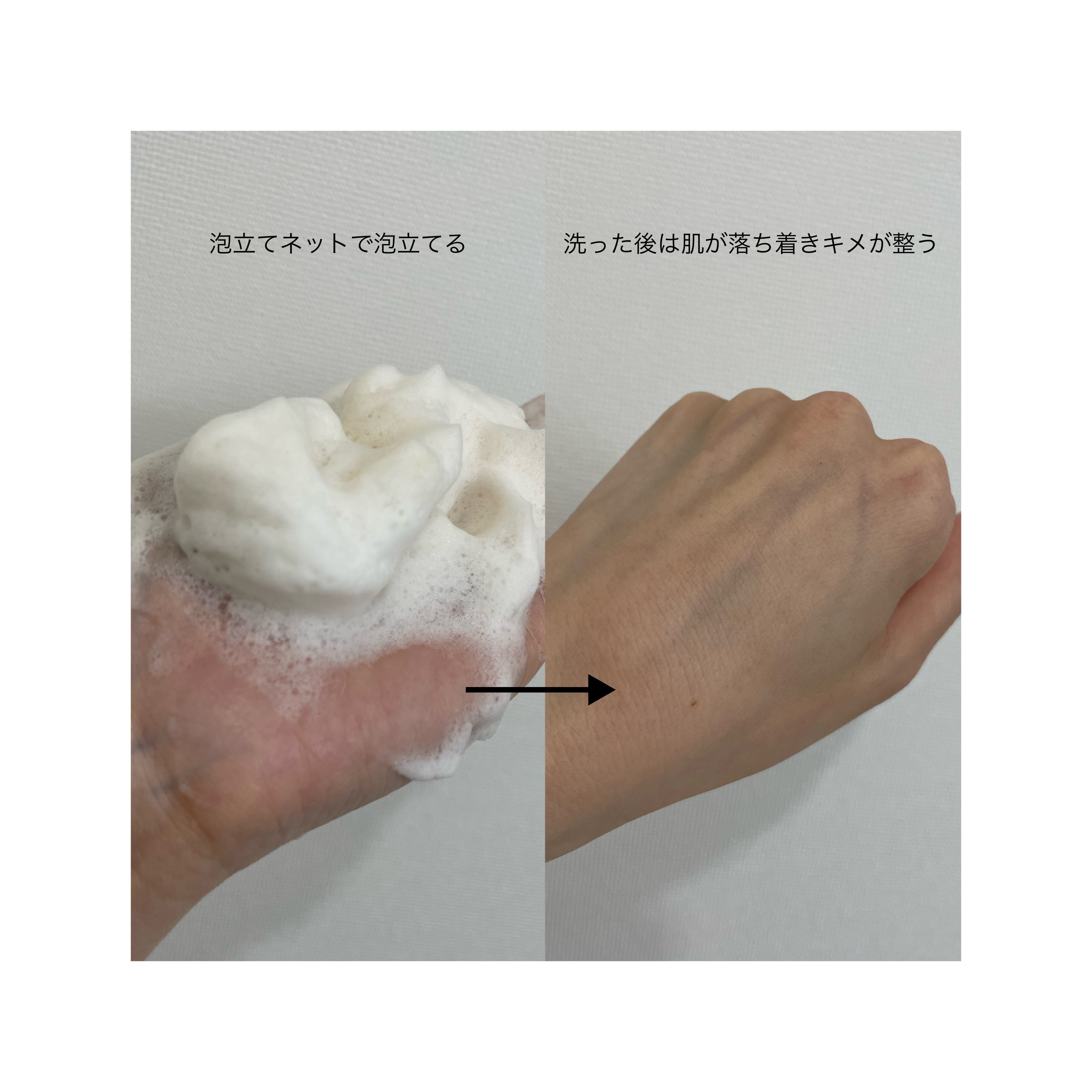 ☆人気☆変色無☆手入れ不要☆肌に優しい☆金属アレルギー&温泉