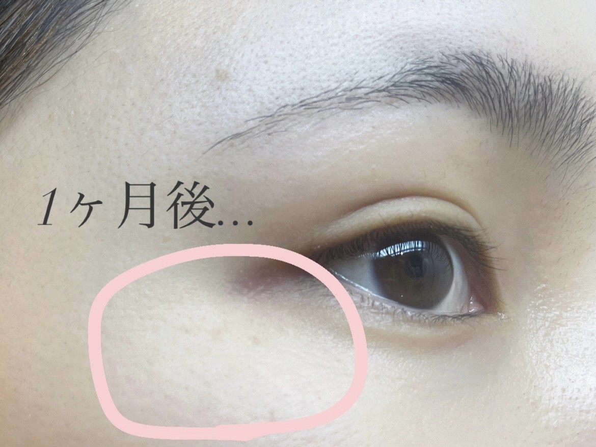 POLA エステ BA ホワイトショット各1点ずつ POLAのホワイトショットを1ヶ月